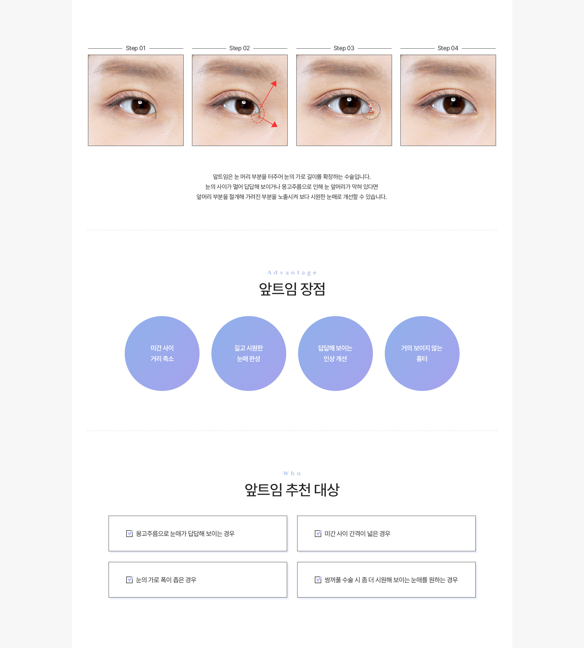 트임 앞트임 내용