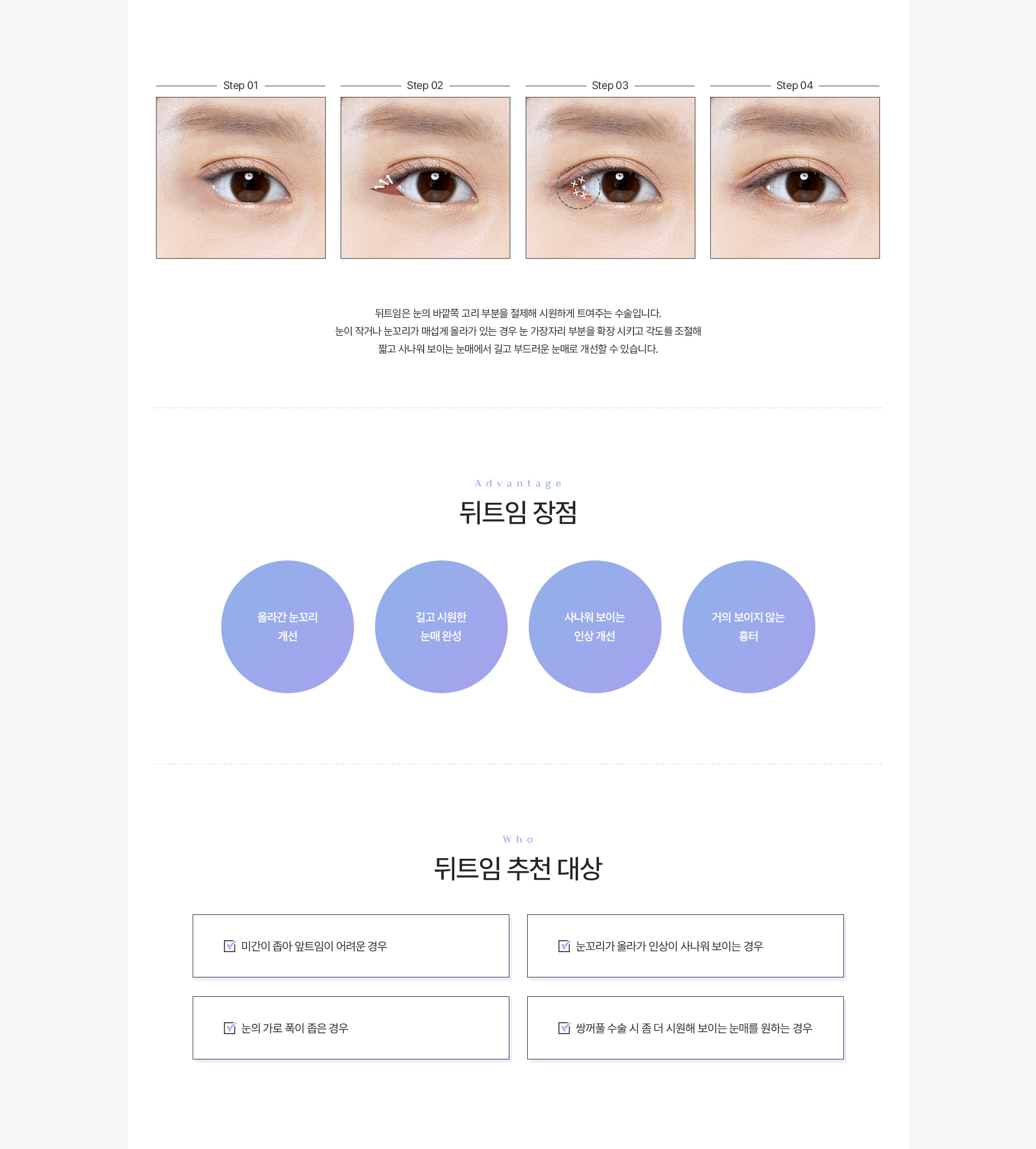 트임 뒤트임 내용