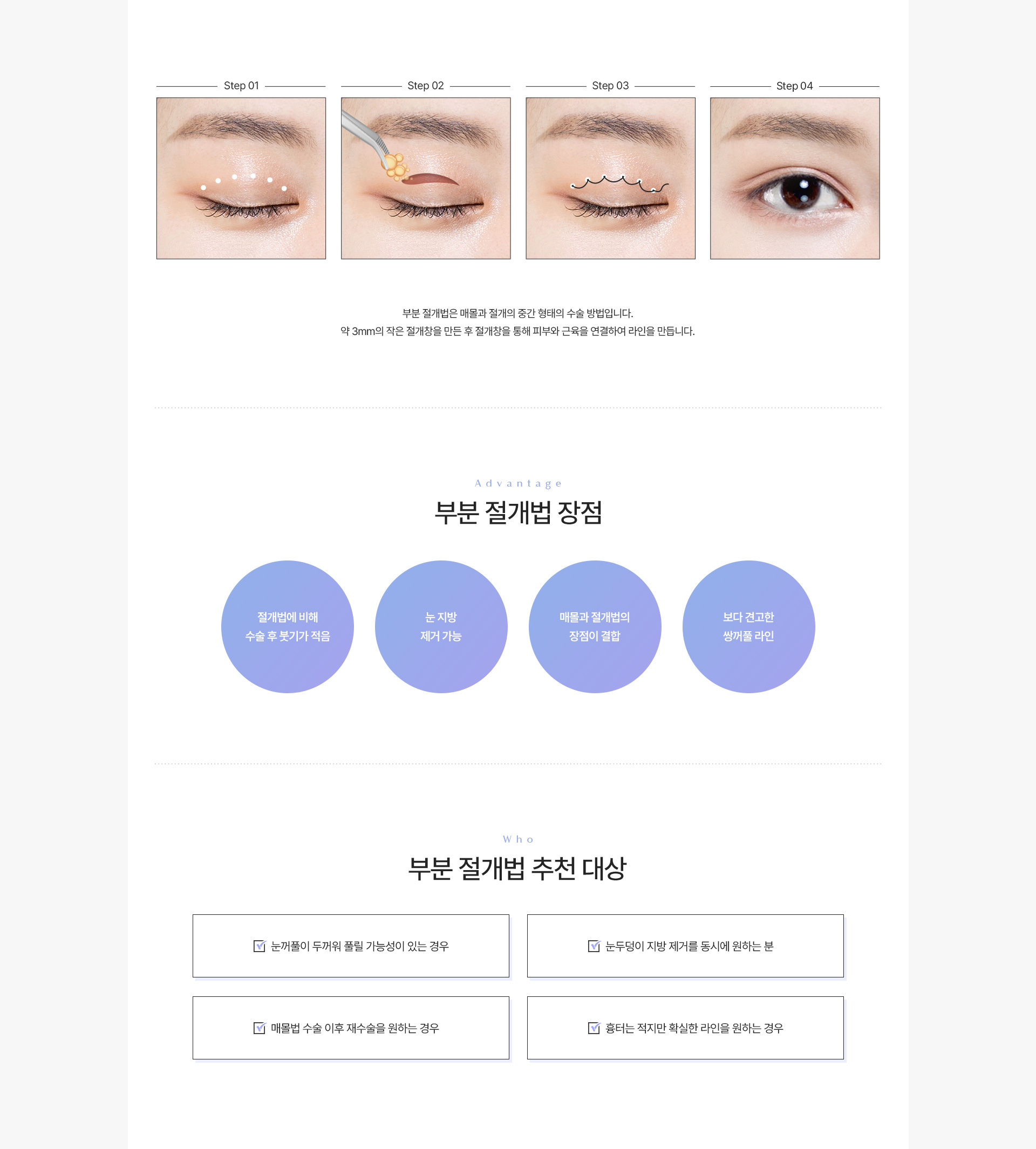 쌍커풀 부분절개법 내용