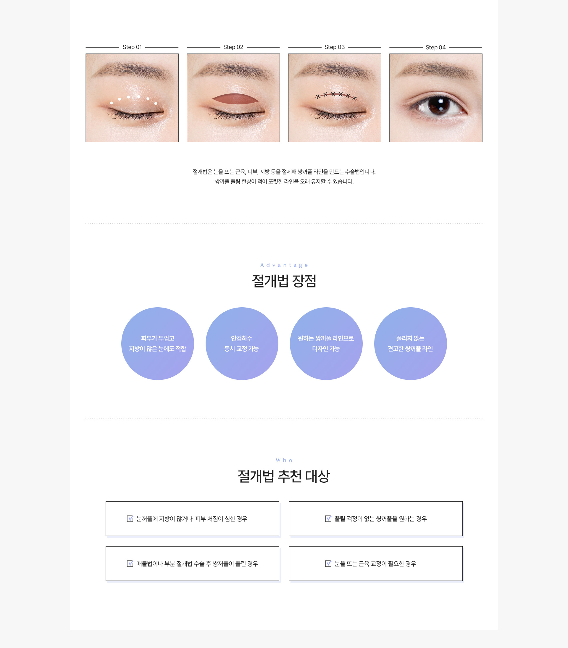 쌍커풀 절개법 내용