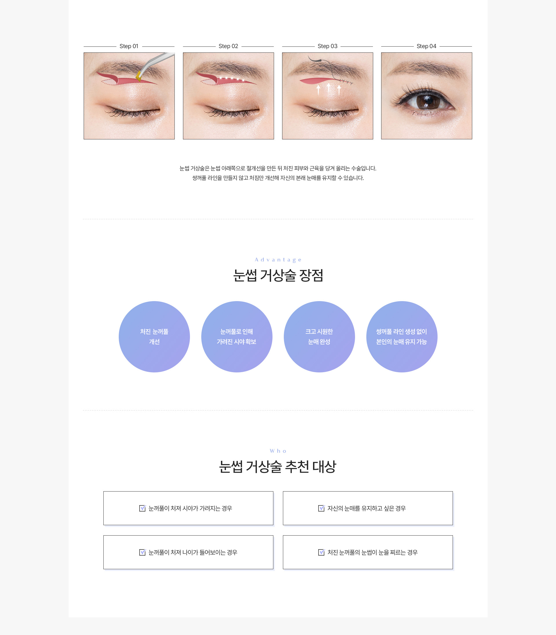중년눈성형 눈썹거상술 내용
