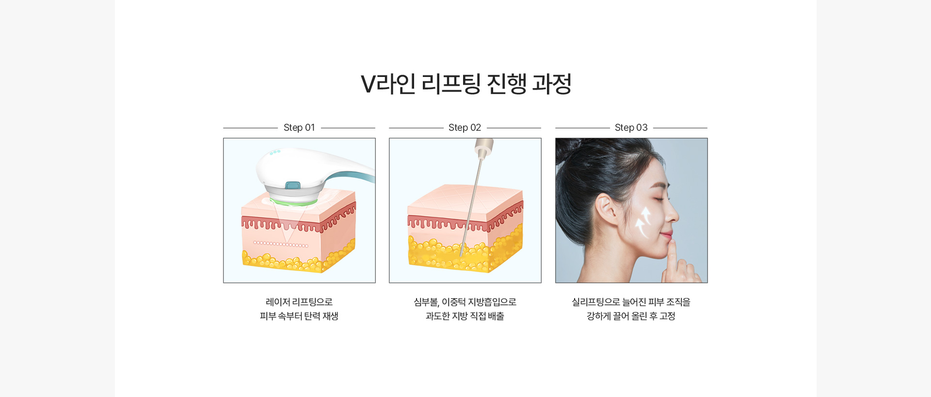 V라인리프팅 진행과정
