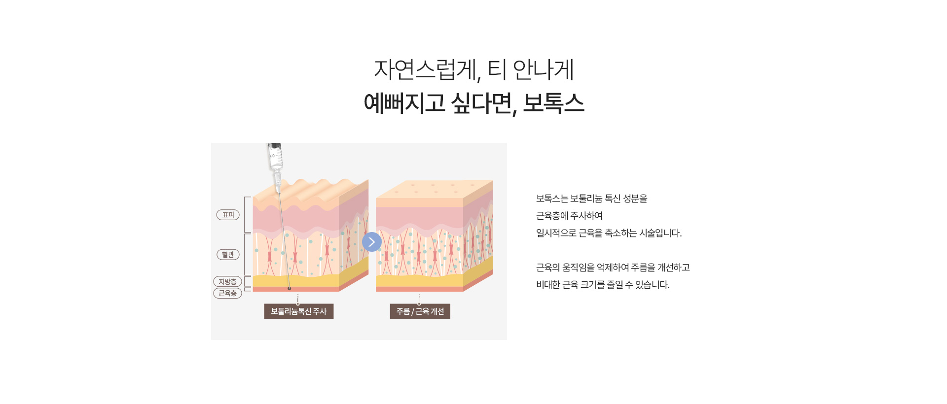 보톡스 내용