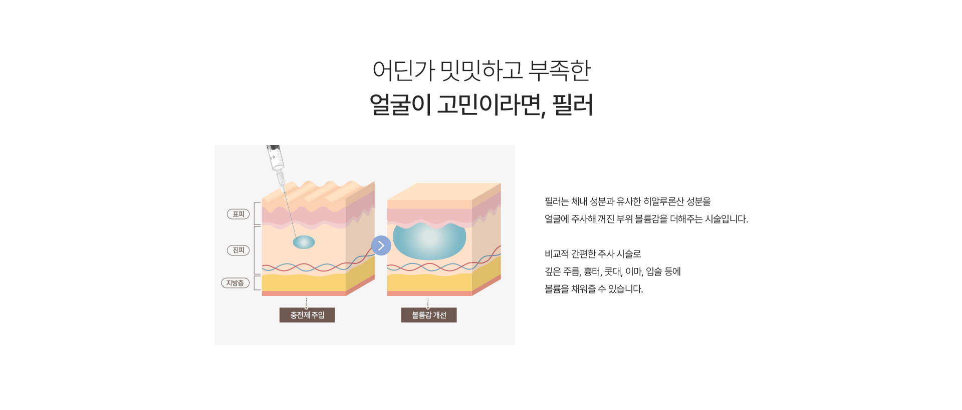 필러 내용