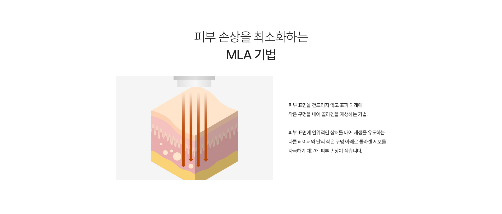 루카스플러스 기법