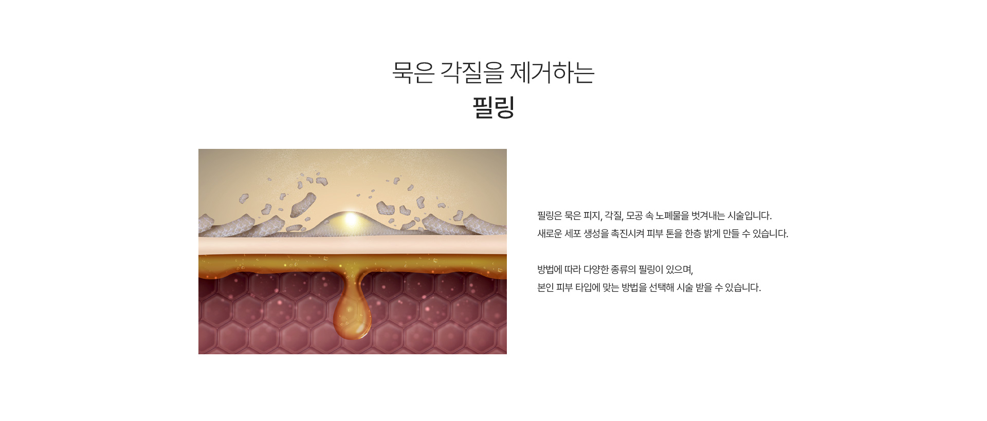 필링 내용