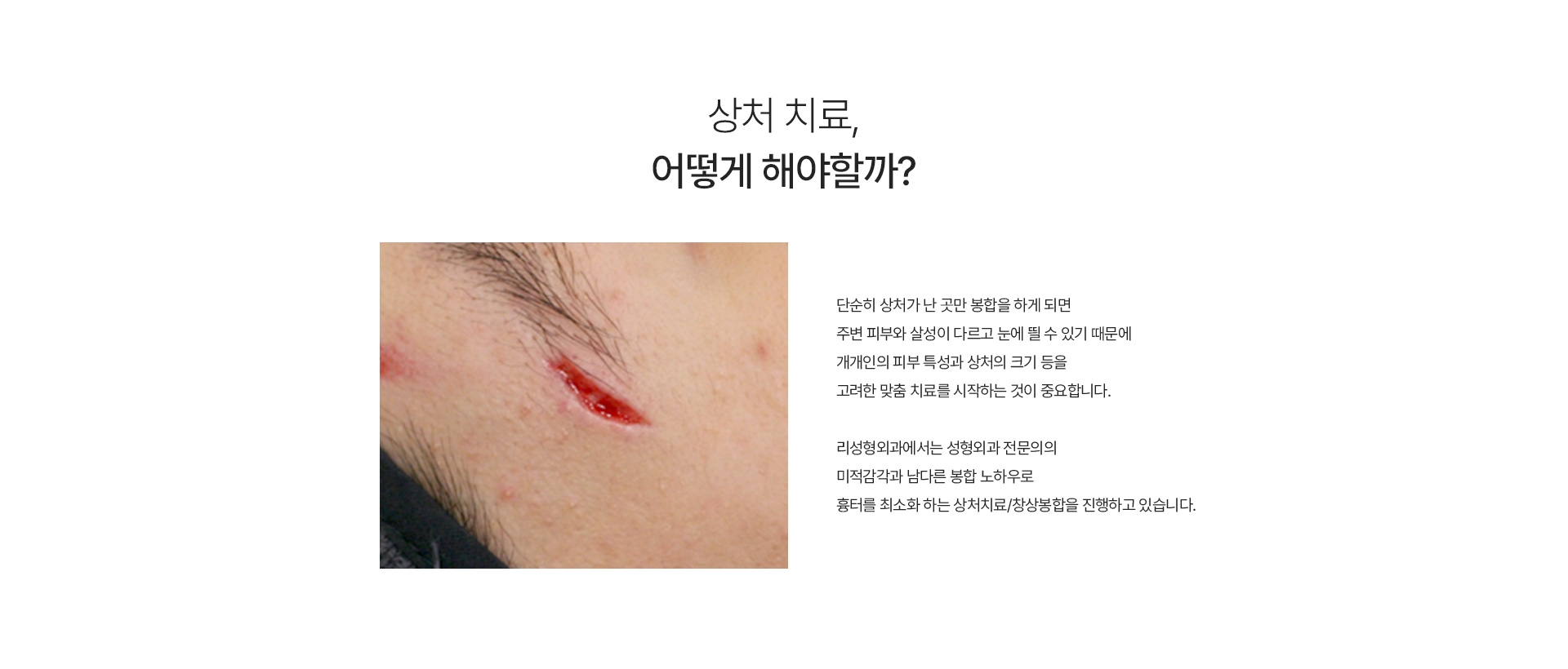창상봉합 내용