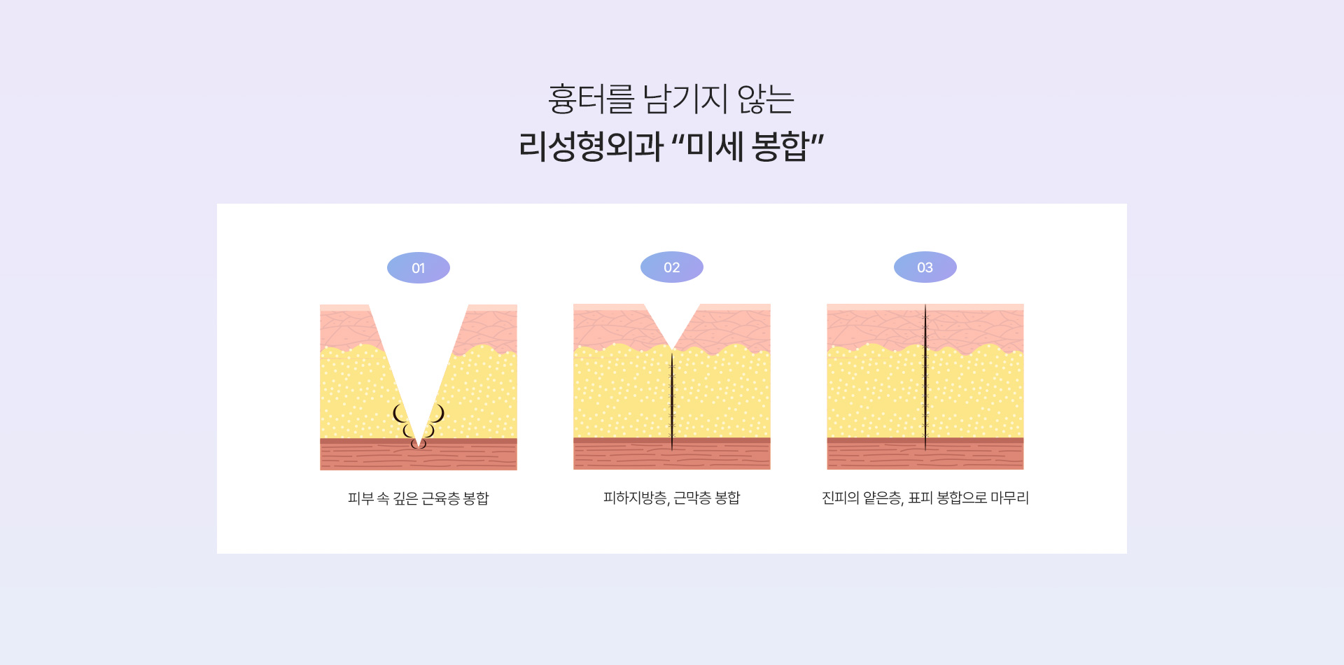 창상봉합 미세봉합
