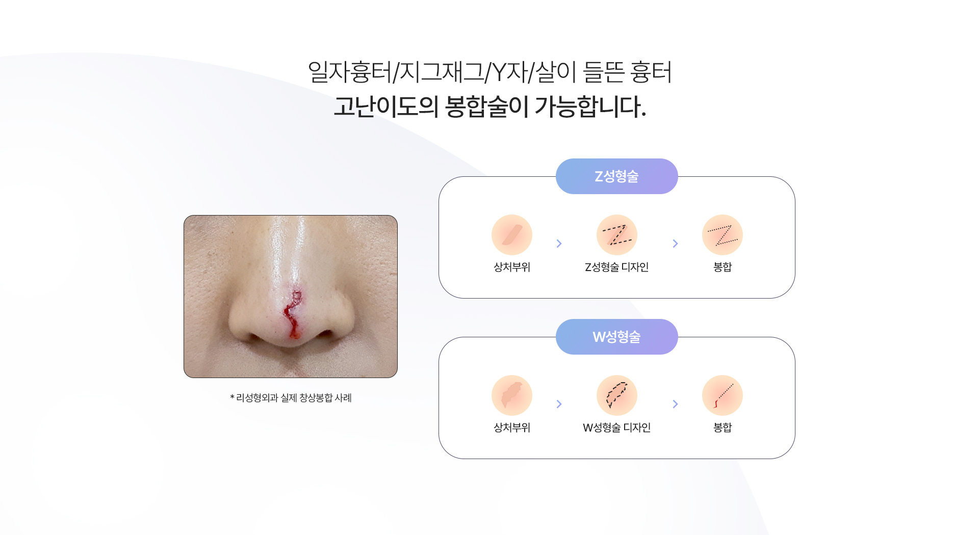창상봉합 고난이도봉합술