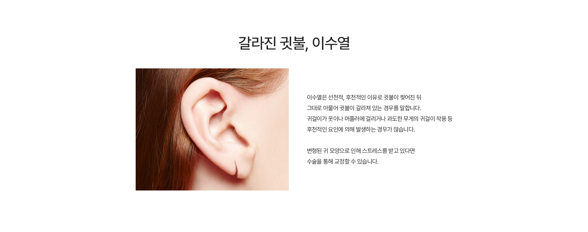 이수열 내용