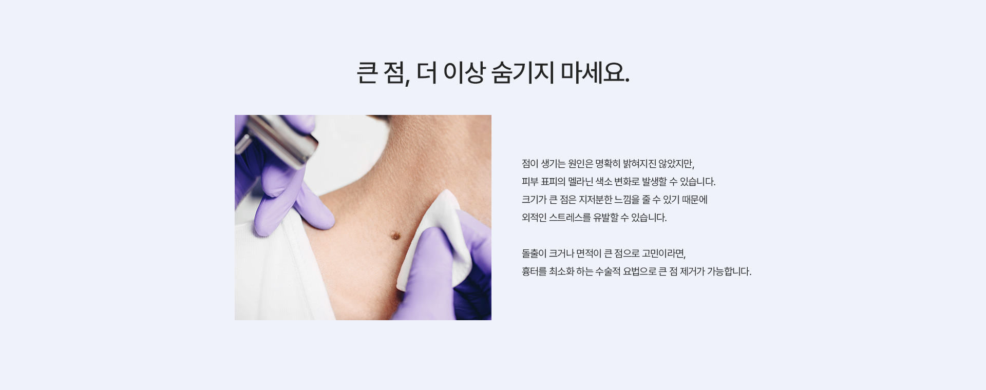이수열 큰점