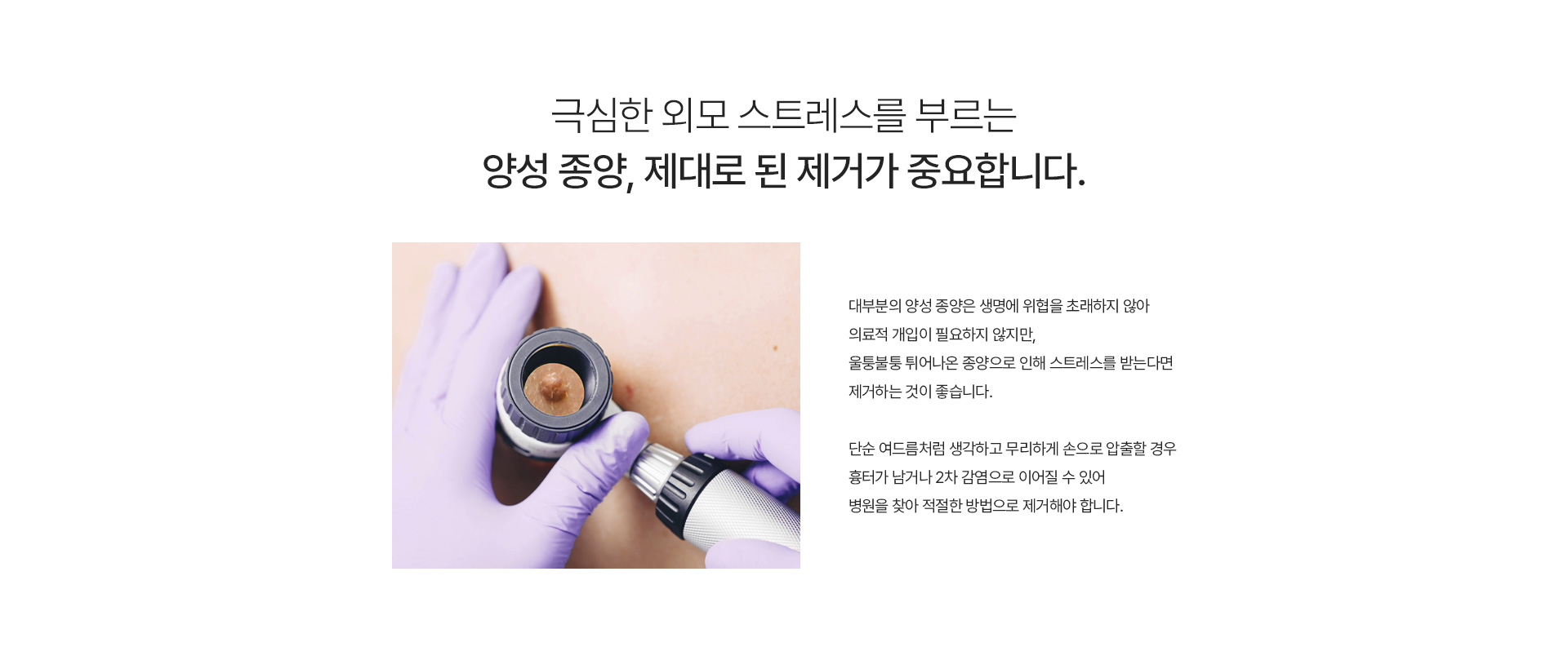 양성종양 내용
