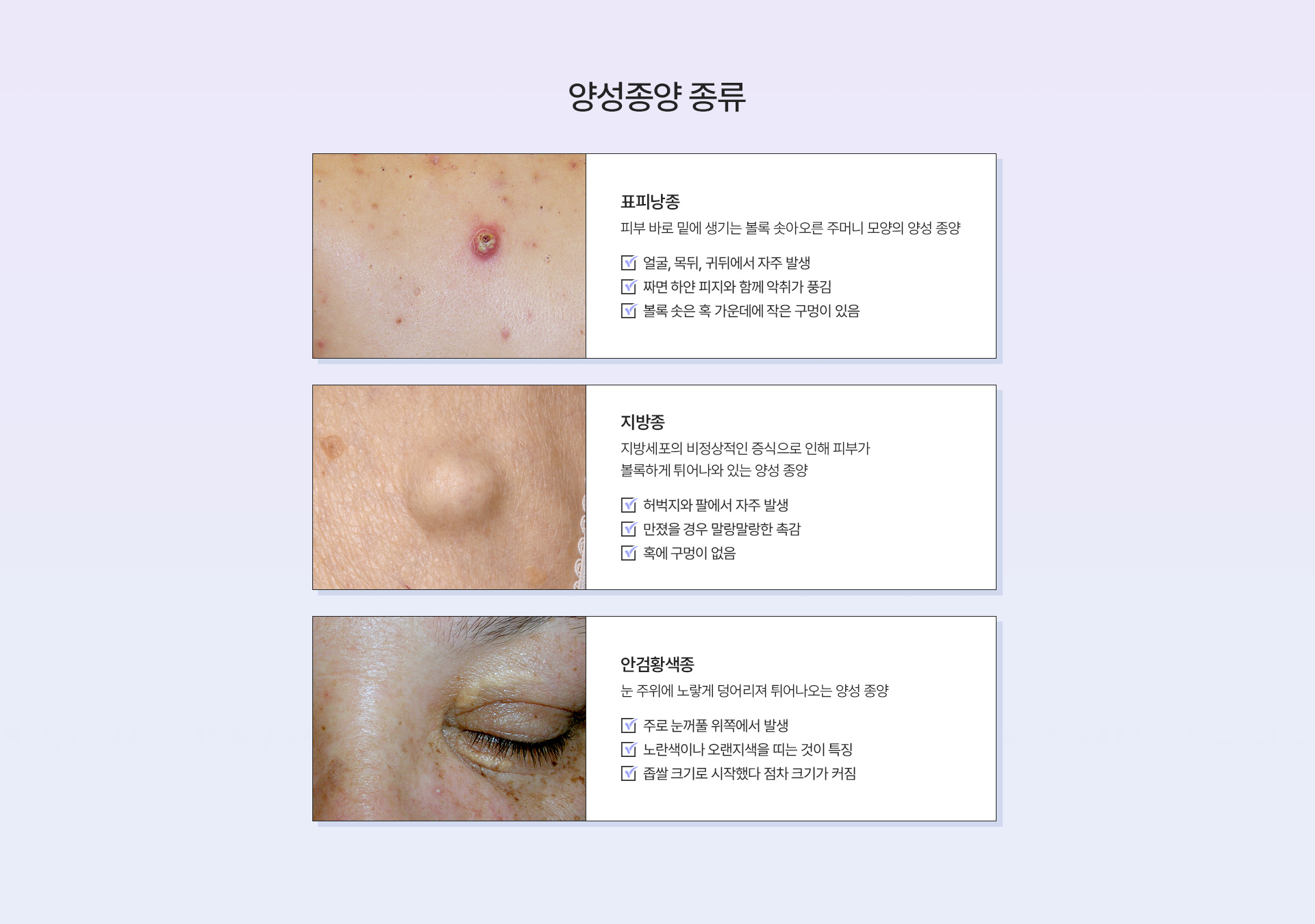 양성종양 종류